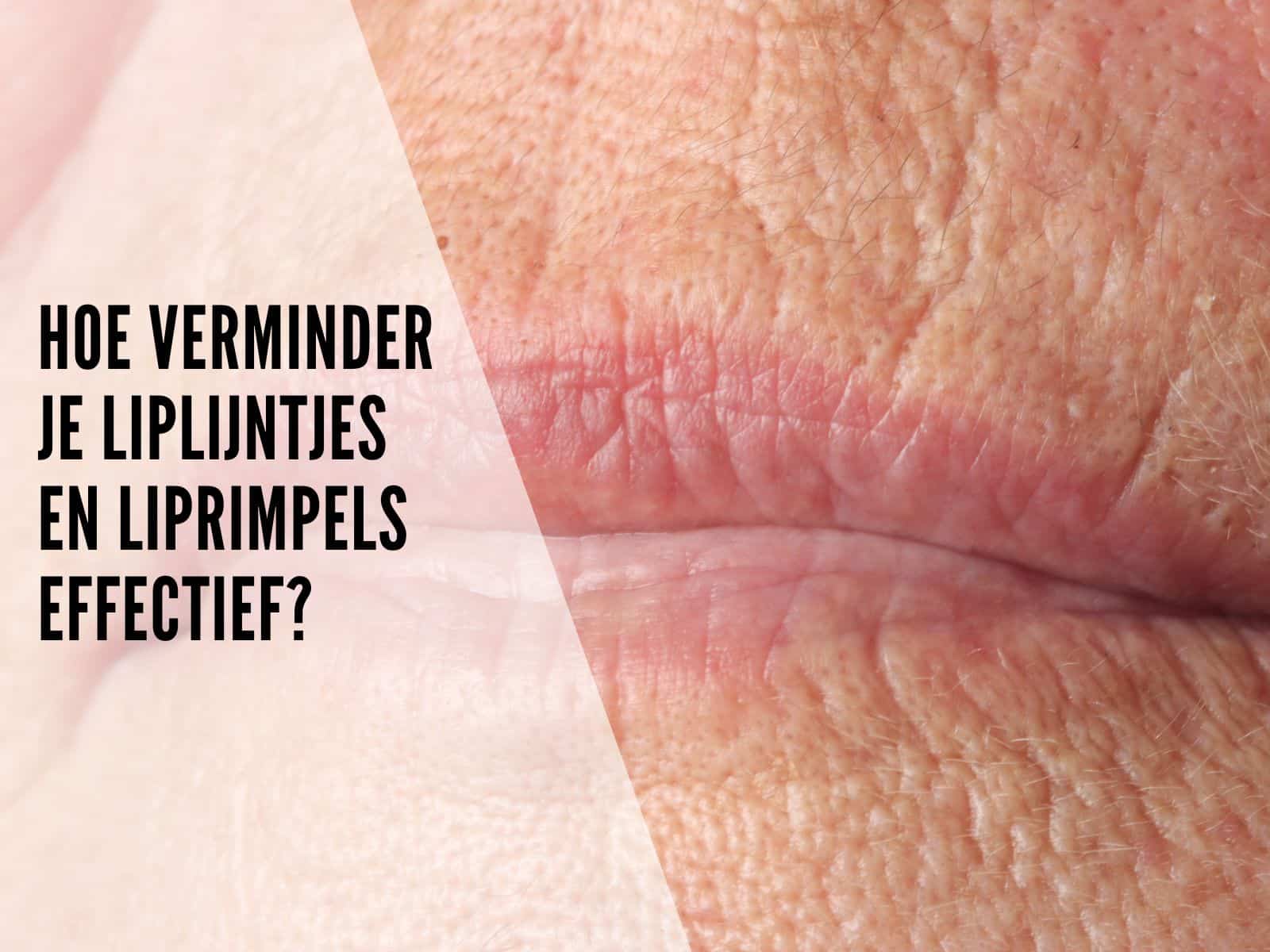 Hoe verminder je liplijntjes en liprimpels effectief?