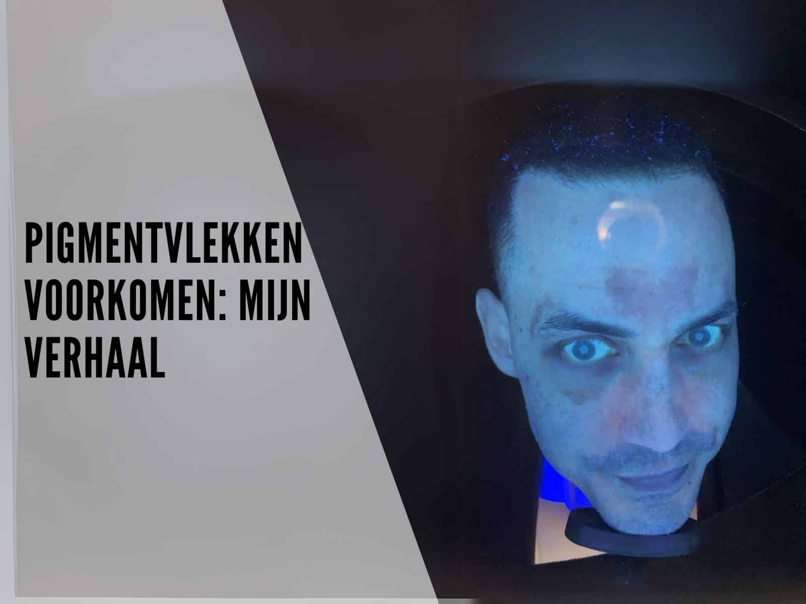 Pigmentvlekken voorkomen mijn verhaal